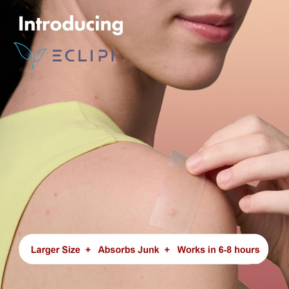 Eclipi Surface Large Pimple Patches 10 PCs – XL Hydrocolloid Strips for Face & Body Acne, Covers Breakout Clusters on Cheeks, Forehead, Chin & Jawline, Easy Peel Pimple Stickers