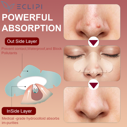 Eclipi Nose Pimple Patches 10 PCs – Hydrocolloid Nose Strips for Acne Care, Absorbs Oil & Pore Impurities Overnight, Gentle & Easy Peel Pimple Stickers for Clearer Looking Skin
