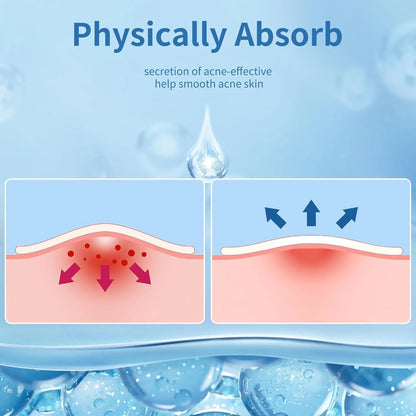 Eclipi Pimple Patches for Face 150 Pack – Hydrocolloid Pimple Stickers for Blemish Care, Oil Absorbing Spot Dots for Clear Looking Skin, Gentle on Sensitive Skin