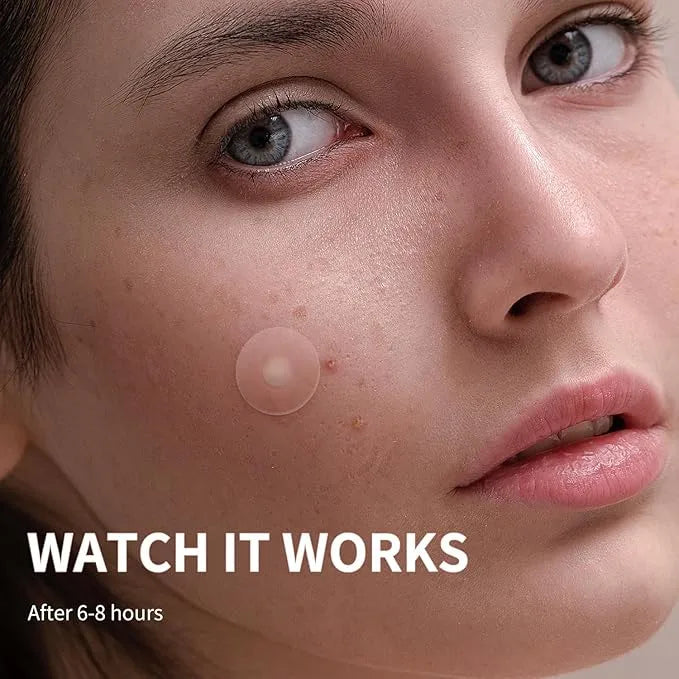 Eclipi Pimple Patches for Face 150 Pack – Hydrocolloid Pimple Stickers for Blemish Care, Oil Absorbing Spot Dots for Clear Looking Skin, Gentle on Sensitive Skin