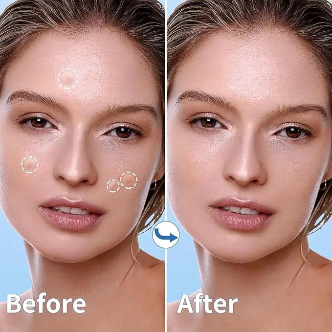 Eclipi Pimple Patches for Face 150 Pack – Hydrocolloid Pimple Stickers for Blemish Care, Oil Absorbing Spot Dots for Clear Looking Skin, Gentle on Sensitive Skin