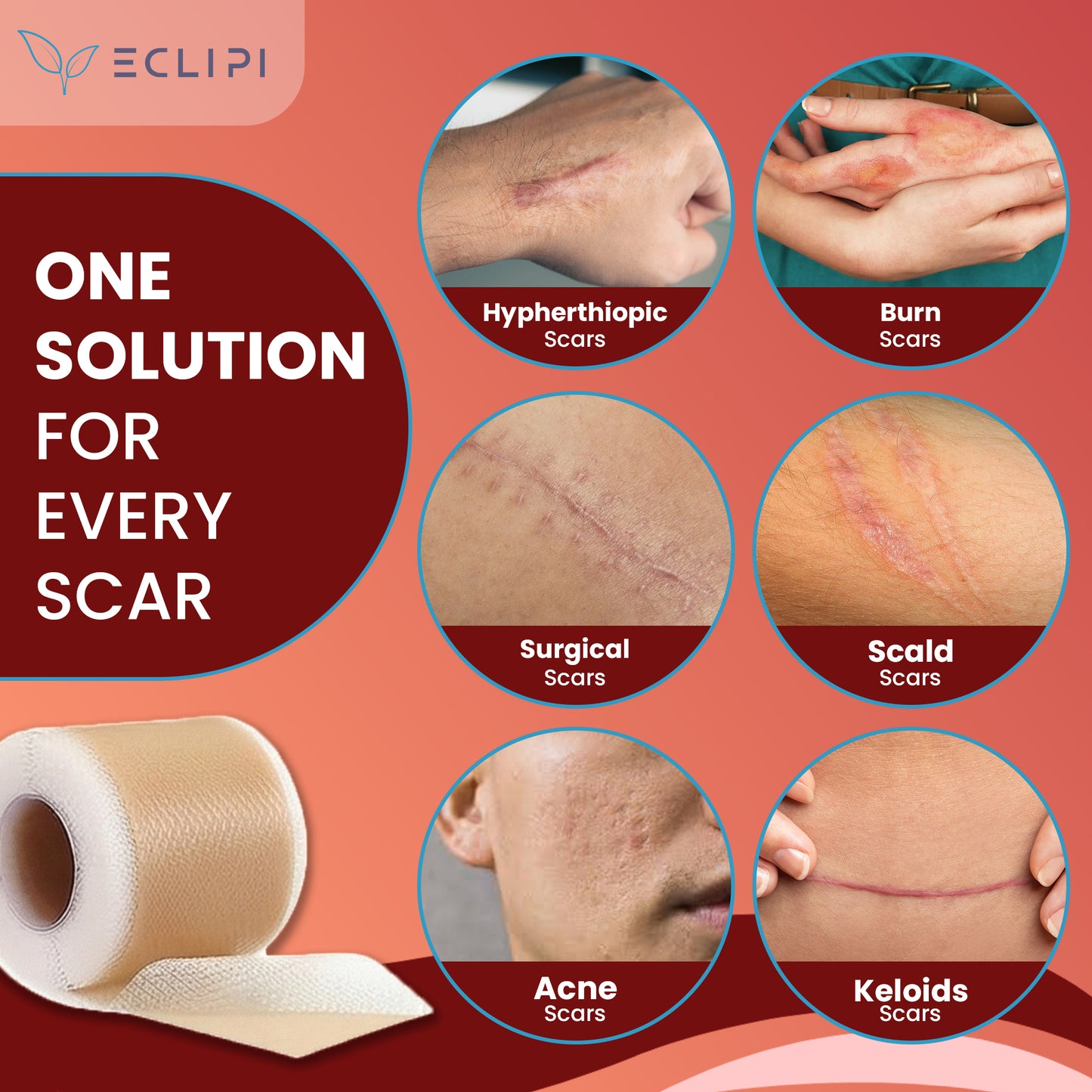 Eclipi Silicone Scar Tape Roll (1.6'' x 60'') – Reusable Sheets for C-Section, Tummy Tuck, Surgical, Burn, and Keloid Scars – Soft, Flexible & Skin-Friendly Strips