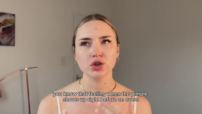 Eclipi Pimple Patches for Face 150 Pack – Hydrocolloid Pimple Stickers for Blemish Care, Oil Absorbing Spot Dots for Clear Looking Skin, Gentle on Sensitive Skin